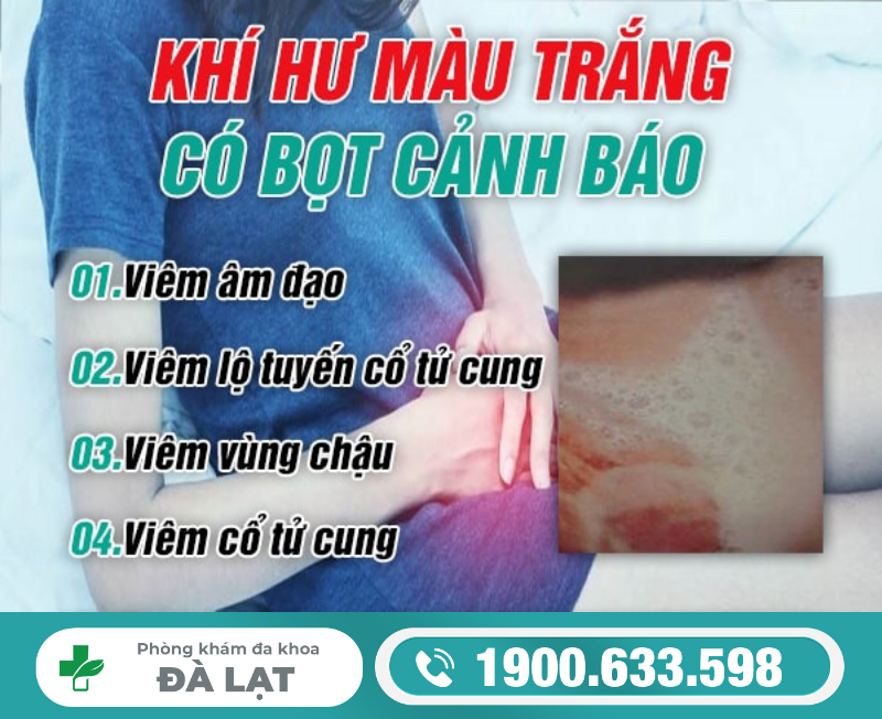 Hình ảnh minh họa